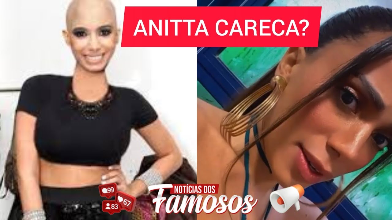 Anitta Careca Cantora DESMENTE ter RASPADO o cabelo para Ritual do Candomblé (VÍDEO COMPLETO)