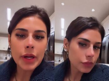 Simone Mendes nega rinoplastia e explica mudança na ponta do nariz